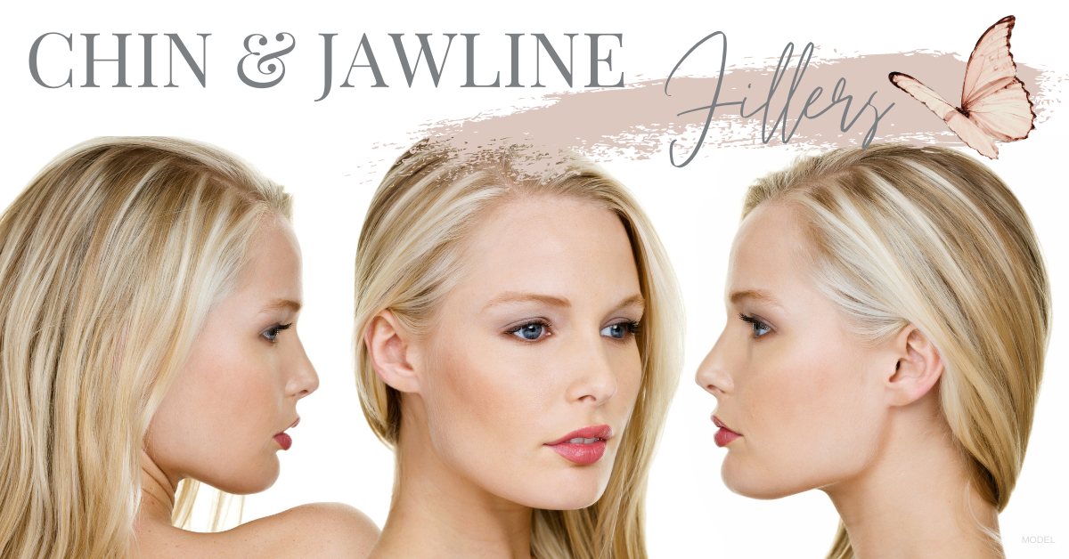 Ever/Body - Defining the jawline with Kybella! This “after” photo